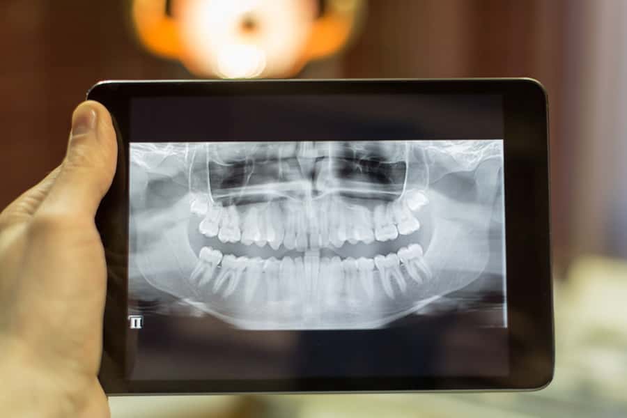 Digital Radiography in Solon, OH