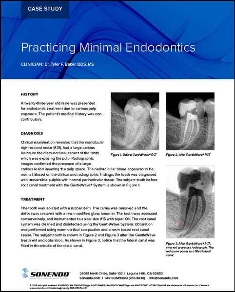 Practicing Minimal Endodontics in Solon, OH