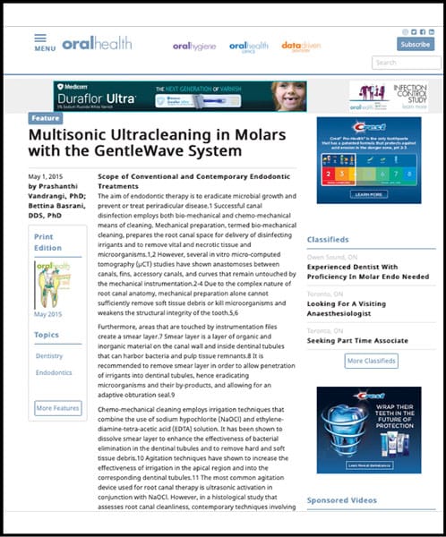 Multisonic Ultracleaning in Molars with the GentleWave System in Solon, OH